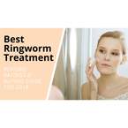 Ring Worm Treatments - Minneapolis, MN, USA