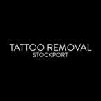 TATTOO REMOVAL STOCKPORT - Stockport, Greater Manchester, United Kingdom