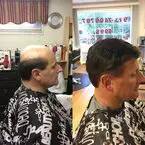 Hair Nonsurgical Replacement - Livingston, NJ, USA