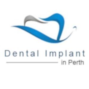 Dental Implant in Perth - Balcatta, WA, Australia