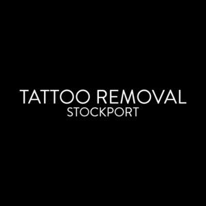 TATTOO REMOVAL STOCKPORT - Stockport, Greater Manchester, United Kingdom