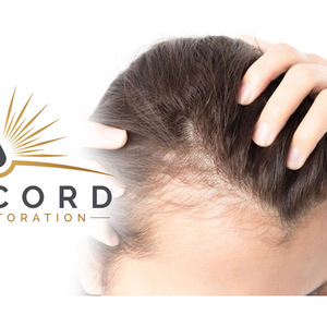 Concord Hair Restoration - San Diego, CA, USA